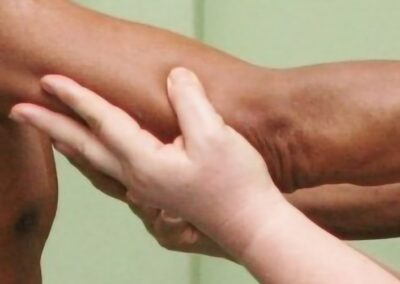 Specialist Bobath treatment to improve arm function and strength after a stroke